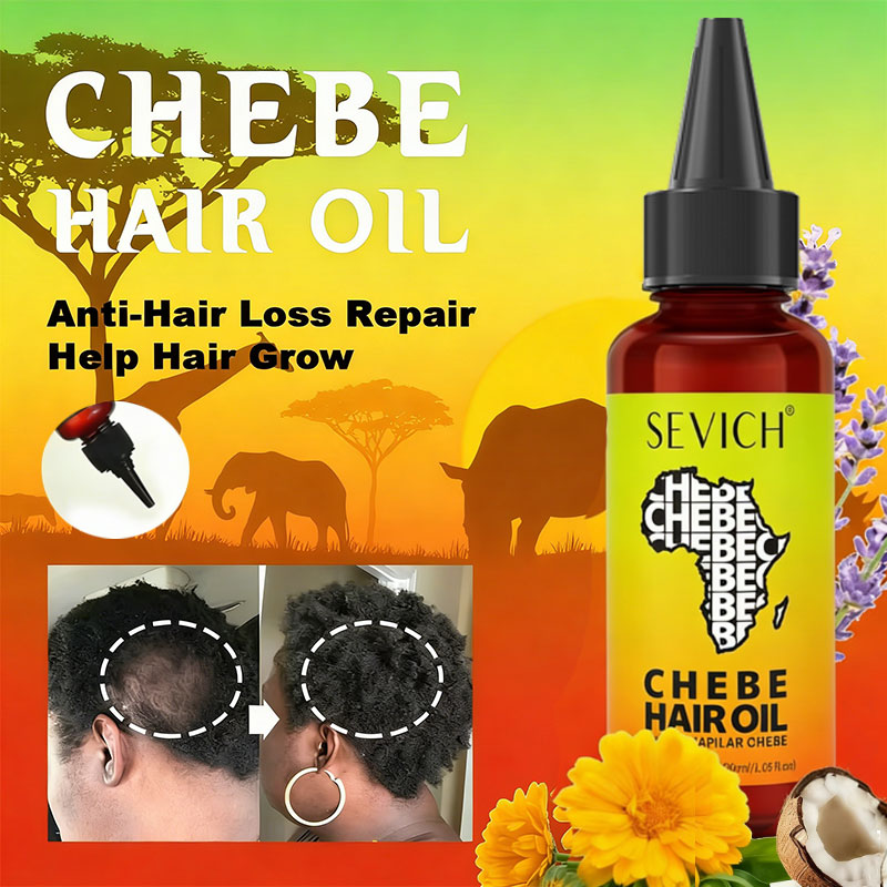 Hair Care Basic - Chebe Fast Hair Growth Oil Africa