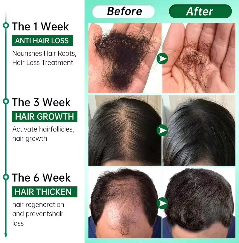 Hair Growth Serum 7 Days Fast  - огляд і ціна Hair Care Basic