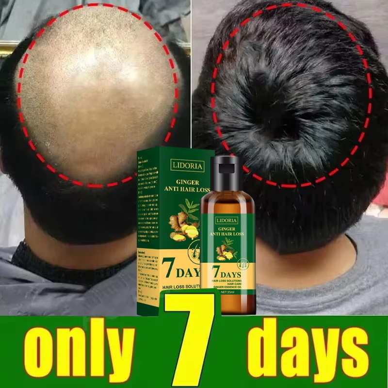 Hair Growth Serum 7 Days Fast  - огляд і ціна Hair Care Basic