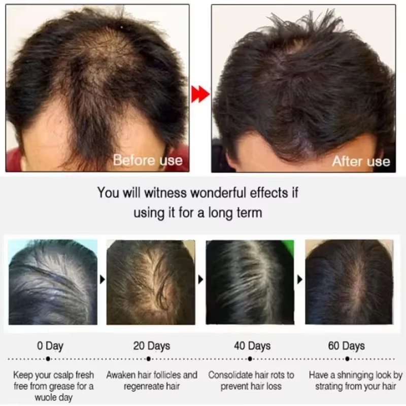 Hair Growth Serum 7 Days Fast  - огляд і ціна Hair Care Basic