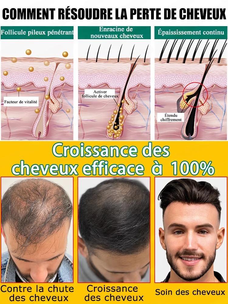 Matches Daily Scalp Care Steps - огляд і ціна Hair Care Steps